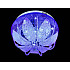 Потолочная люстра SL1M 000027610